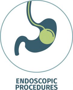 Endoscopic Weight Loss Procedures