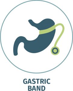 Gastric Band, Lap Band