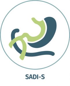 SADI-S, SADI Weight Loss Surgery Procedure